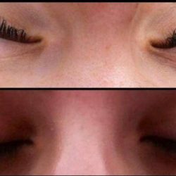 Eyelash Extensions